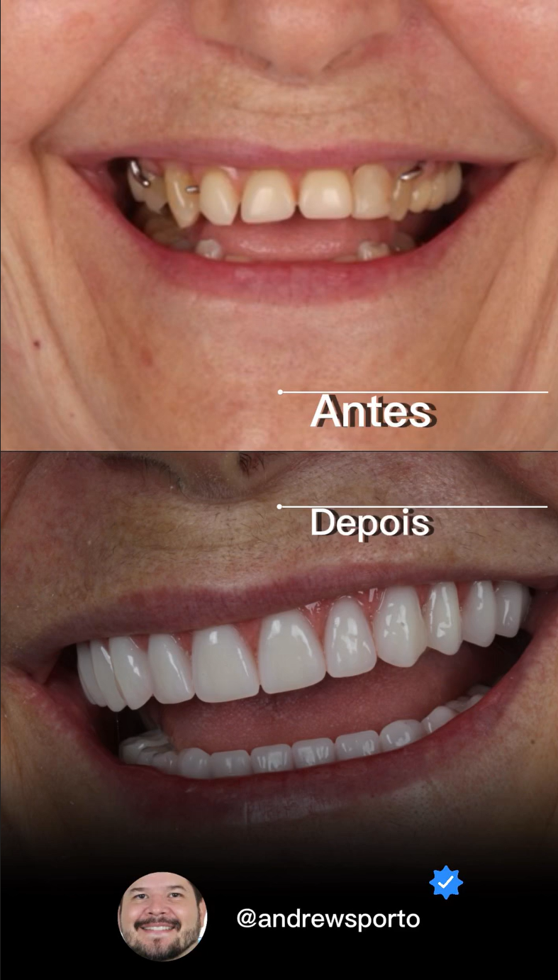 Caso 1 — antes e final